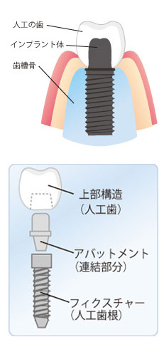 �C���v�����g�̎d�g�݁E�\���b������������