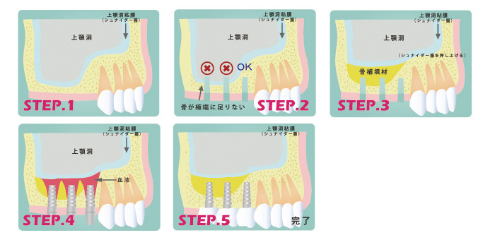 �\�P�b�g���t�g�̗���b������������