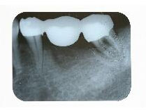 ���{��P��