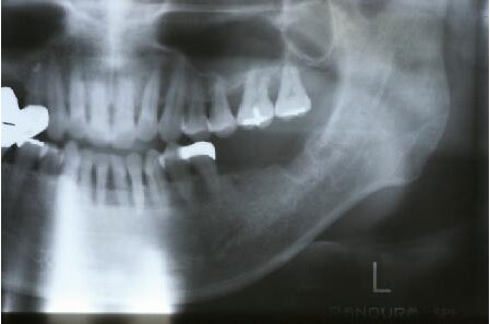 ���{�̃C���v�����g