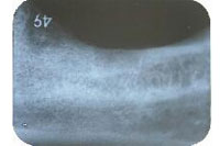 �C���v�����g�O