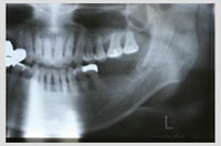 �����������ȏǗ�P�摜