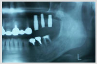 �����������ȏǗ�4�摜